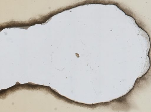 Keratella tropica aspina