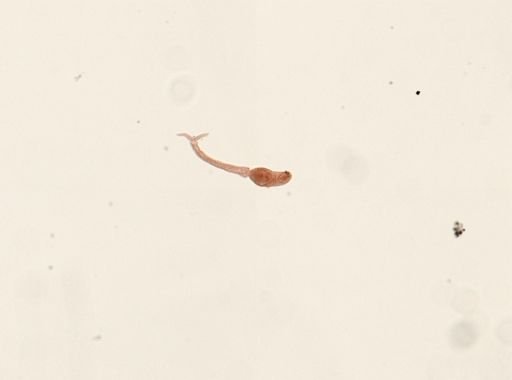 Schistosoma mansoni