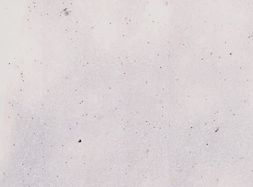 Plasmodium malariae