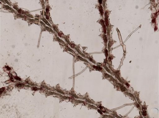 Bryozoa
