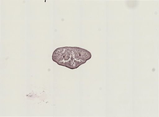 Foviella