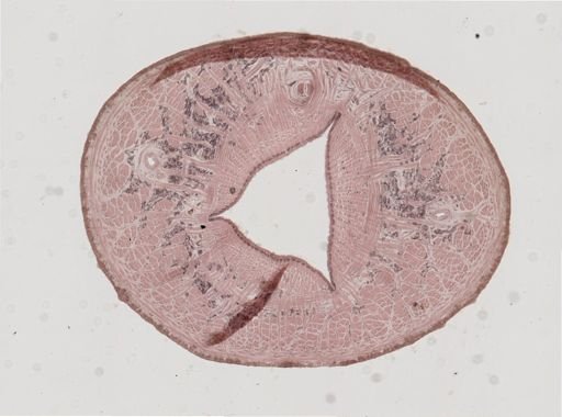Erpobdella punctata