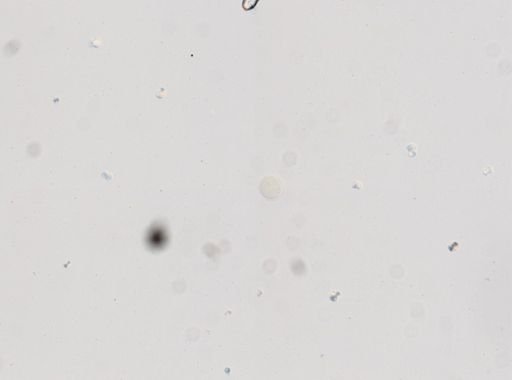 Toxocara cati