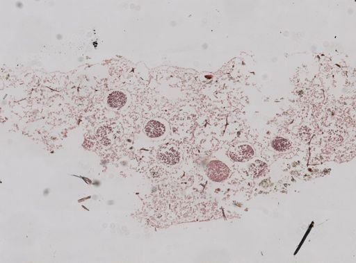 Chalinula loosanoffi