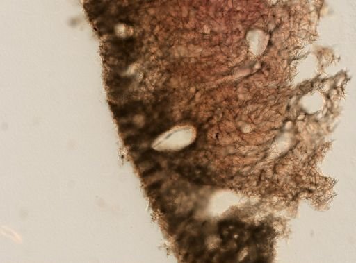 Plakortis sp.