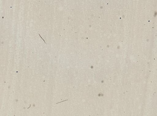 Plasmodium falciparum