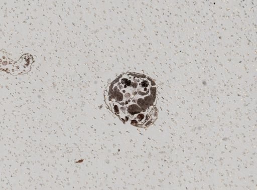 Microsporidia