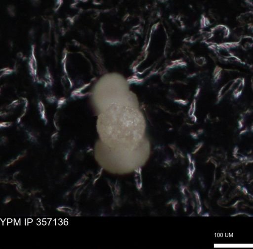 undet. Foraminiferida