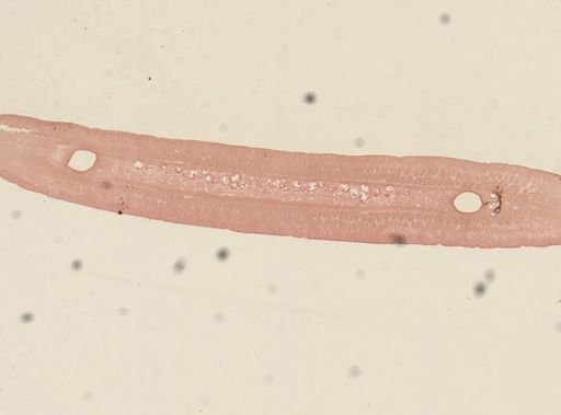 Taenia taeniaeformis