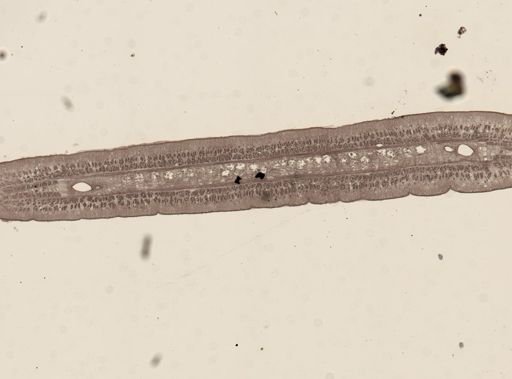 Taenia taeniaeformis