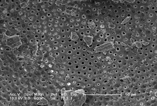 Globorotalia menardii
