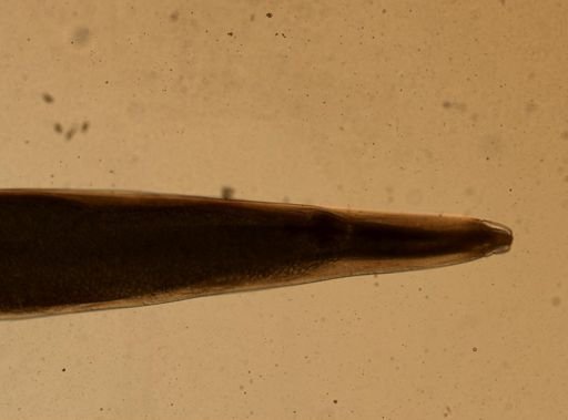 Enterobius vermicularis