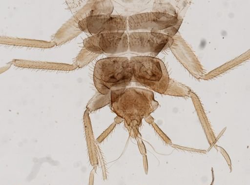 Cimex lectularius