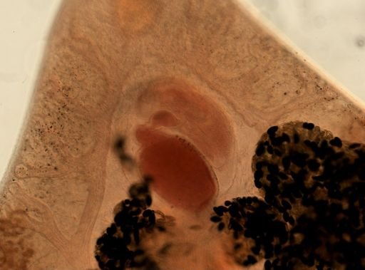 Fasciola hepatica