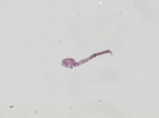 Hyalella cf. azteca