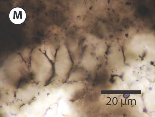 Variomargosphaeridium gracile