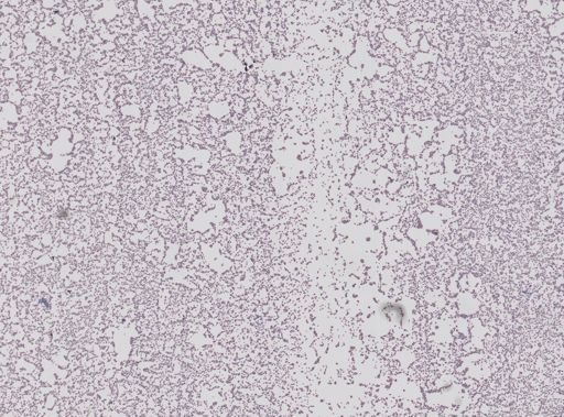 Plasmodium cathemerium