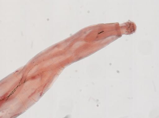 Oligacanthorhynchus microcephalus