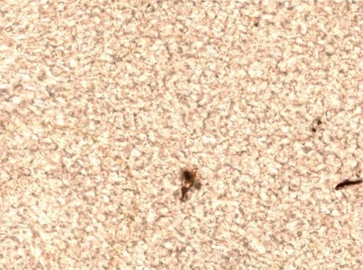 Trichocerca longiseta