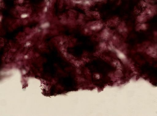 Lissodendoryx noxiosa
