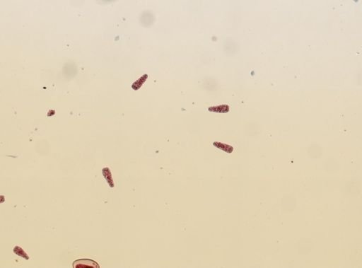 Fasciola hepatica