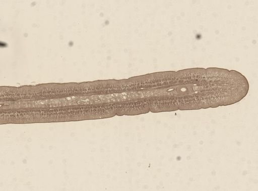 Taenia taeniaeformis