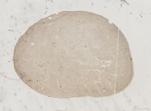 Monocystis agilis