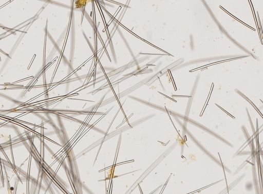 Asteropus cf. ketostea