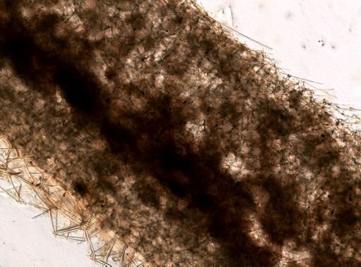 Sympagella nux