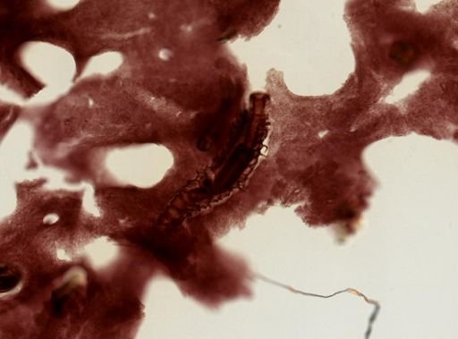 Aplysina fistularis