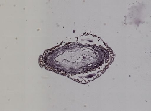 Lineus ruber