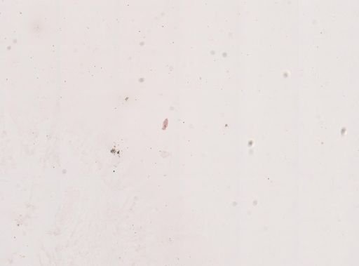 Paramecium