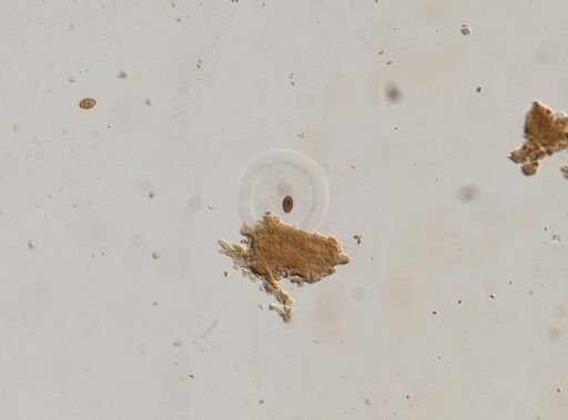 Diphyllobothrium canis