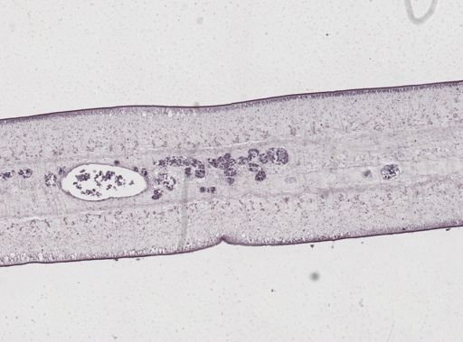 Taenia saginata