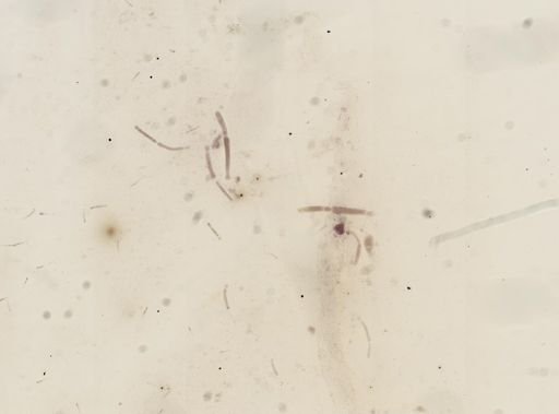 Clepsidrina polymorpha