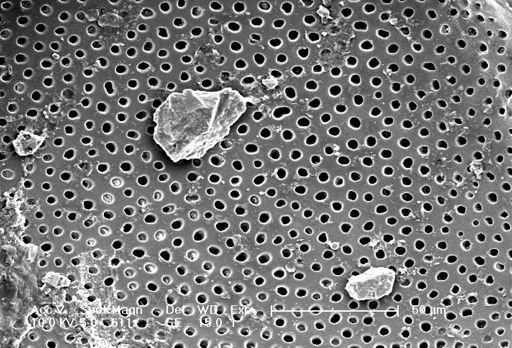 Globorotalia menardii