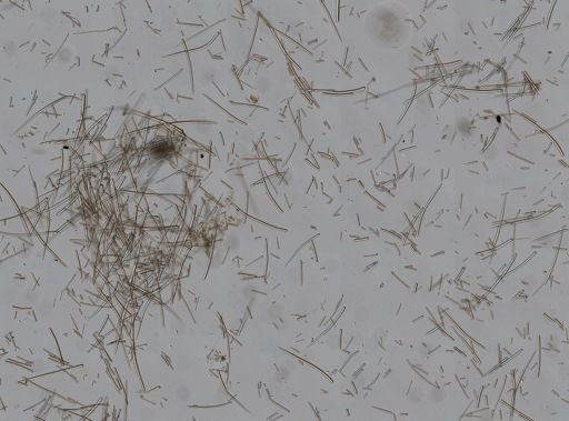 Ptilocaulis cf. walpersii
