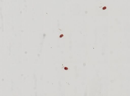 Trematoda