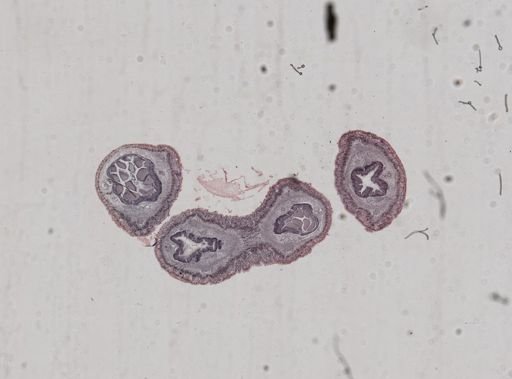 Lineus sanguineus