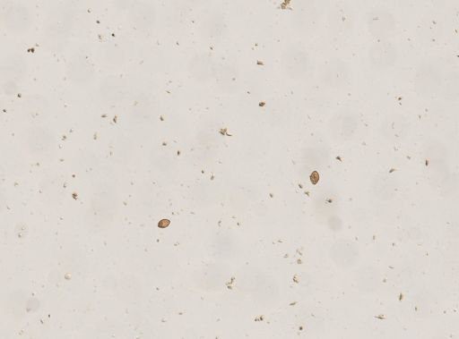 Diphyllobothrium canis