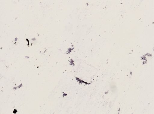 Onchocerca volvulus
