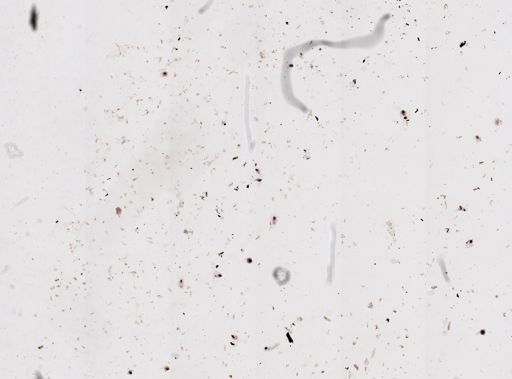 Protozoa
