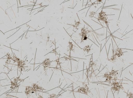 Tedania suctoria