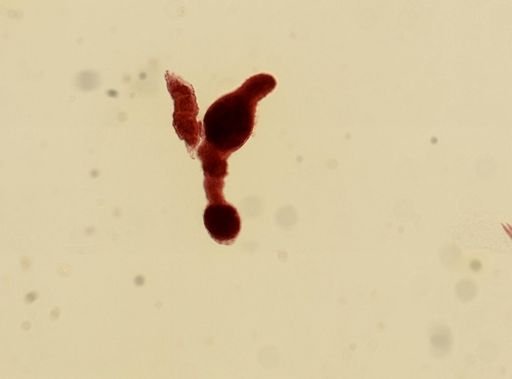 Digenea