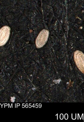 Spirolocammina planula