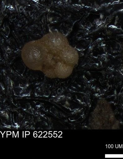 undet. Rugoglobigerinidae