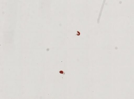 Trematoda