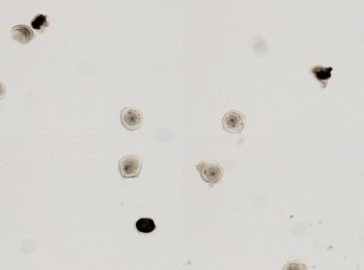 Ascaris megalocephala