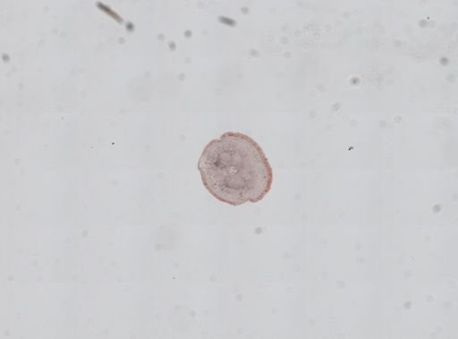 Nemertea