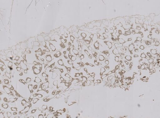Astrosclera
